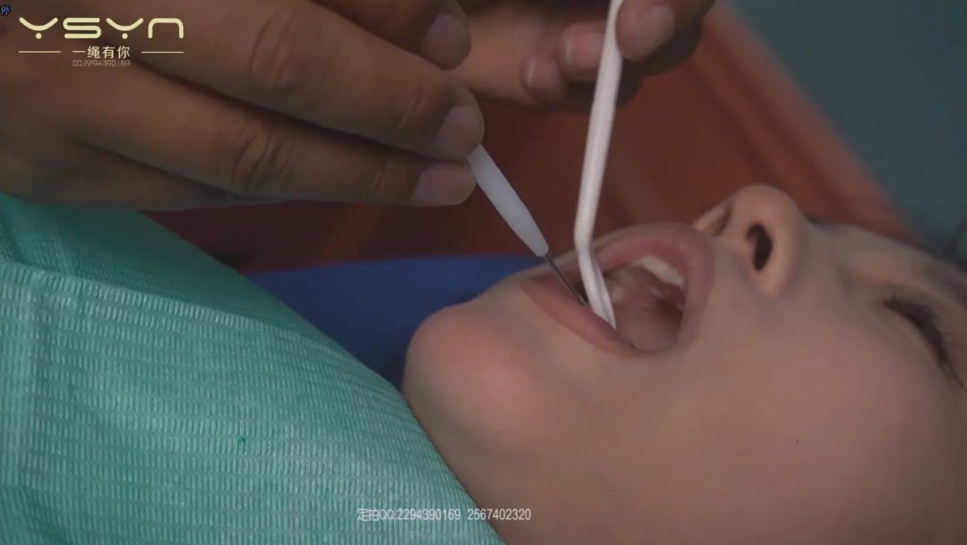 【牙科风波】学生牙疼看牙医特殊首创疗法检查口腔捆绑四肢不打麻针拔牙后被威胁椅缚蒙眼堵嘴打晕装麻袋-6