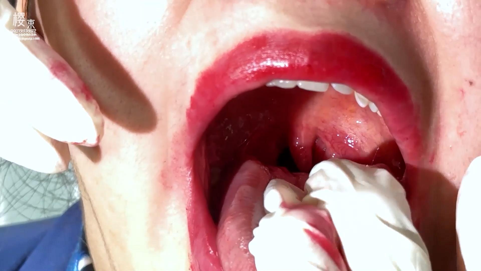 20c77940f97db7c30993b5e76a1aa09b