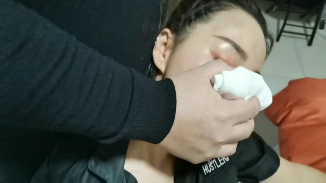 雅思 强行禁锢在k9架跪爬器上 电击-1