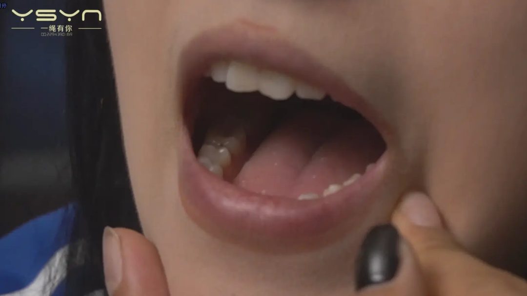 【牙科风波】学生牙疼看牙医特殊首创疗法检查口腔捆绑四肢不打麻针拔牙后被威胁椅缚蒙眼堵嘴打晕装麻袋-5